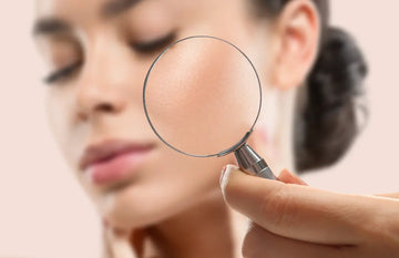 What is combination skin type: How to Identify & Treatment